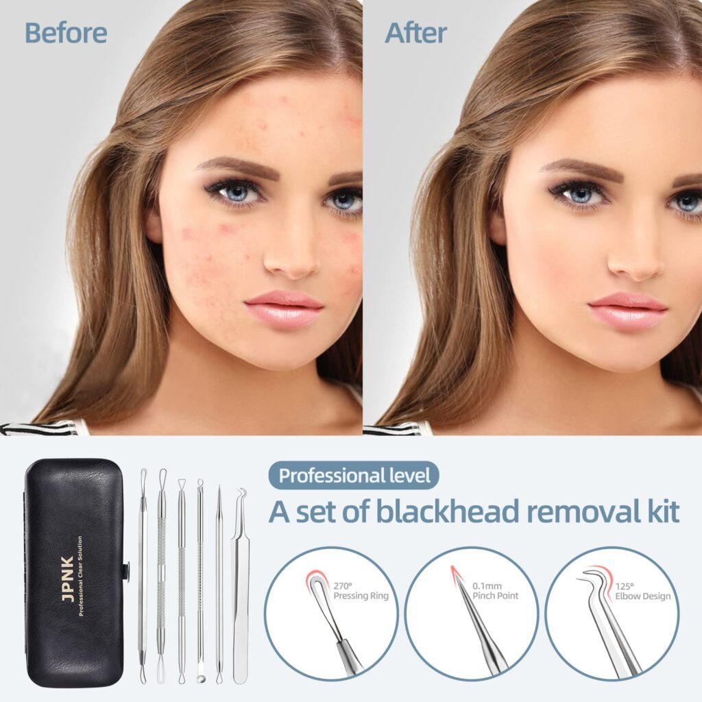 JPNK 6-Piece Blackhead & Comedone Extractor Kit with Storage Case