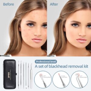 JPNK 6-Piece Blackhead & Comedone Extractor Kit with Storage Case - Image 6