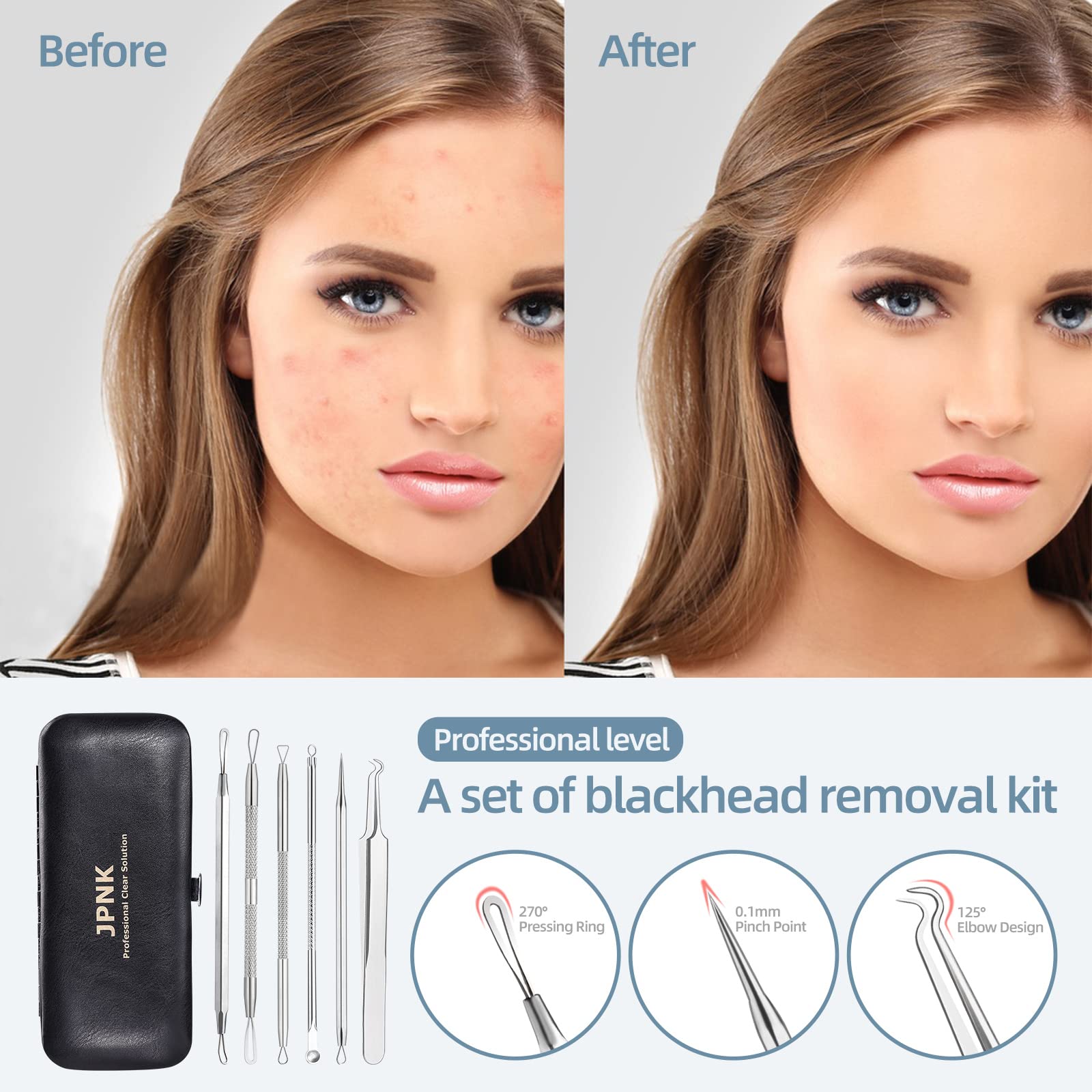 JPNK 6-Piece Blackhead & Comedone Extractor Kit with Storage Case - Image 6