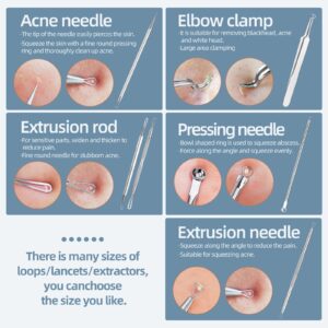 JPNK 6-Piece Blackhead & Comedone Extractor Kit with Storage Case - Image 5
