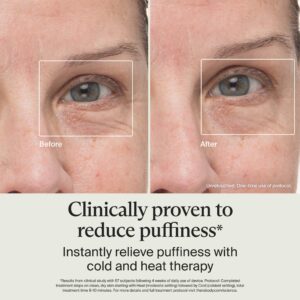Therabody TheraFace Depuffing Wand – Hot & Cold Facial Skincare Treatment - Image 7