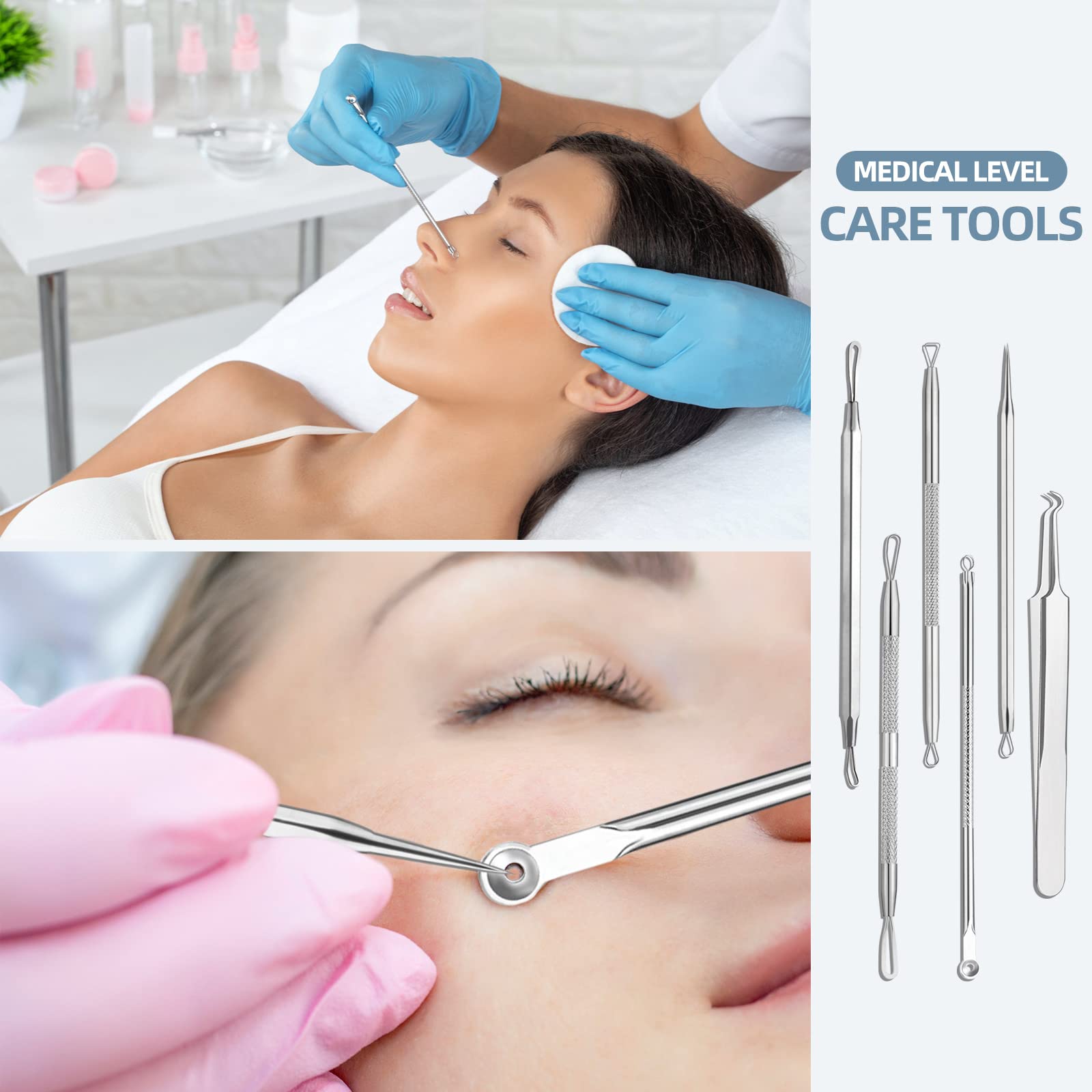 JPNK 6-Piece Blackhead & Comedone Extractor Kit with Storage Case - Image 2