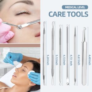 JPNK 6-Piece Blackhead & Comedone Extractor Kit with Storage Case - Image 4